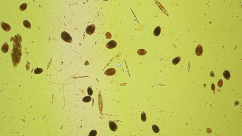 Die giftige Alge Ostreopsis Ovata ist nur unter dem Mikroskop sichtbar. | Bild: ARD/Studio Rom Die giftige Alge Ostreopsis Ovata ist nur unter dem Mikroskop sichtbar.