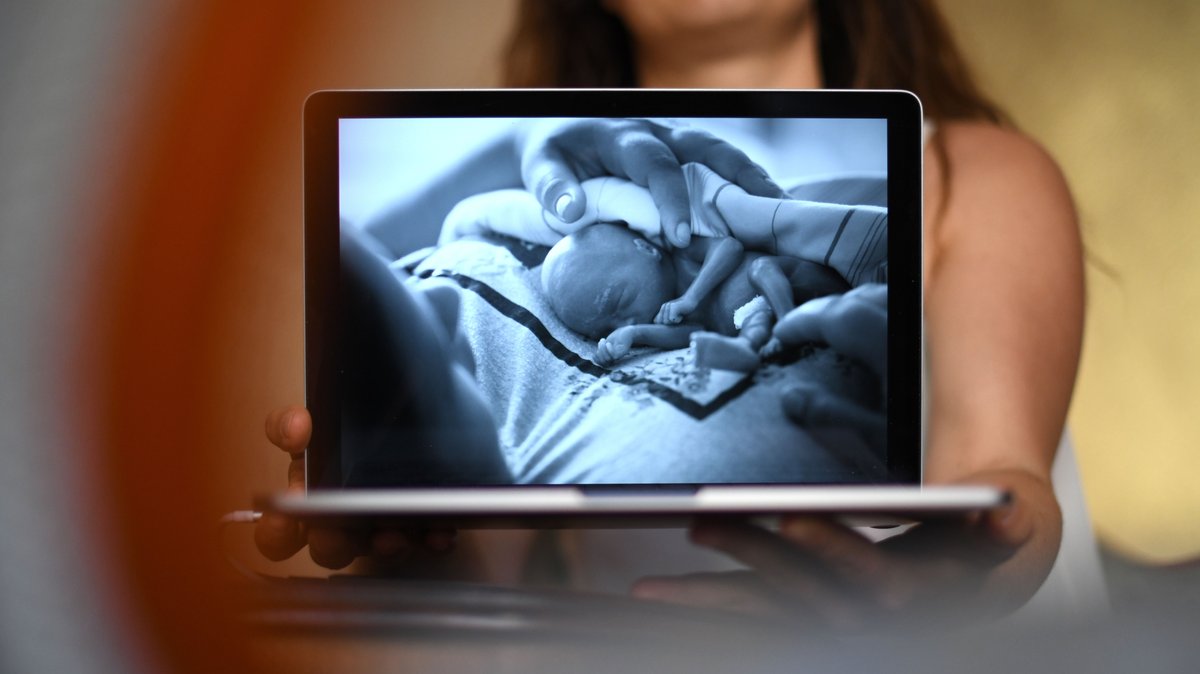 Auf einem Laptop ist das Bild eines Sternenkinds zu sehen, das bei seiner Mutter auf der Brust liegt. 