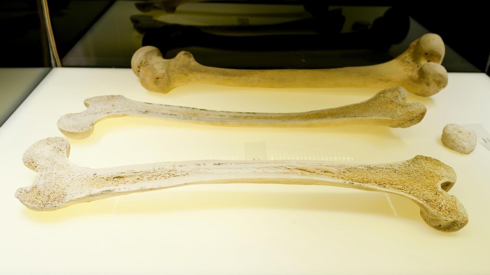Forscher entdecken neue Gefäße im menschlichen Knochen