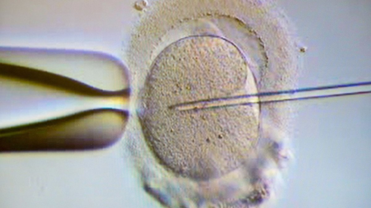 Vor 40 Jahren: Das erste Baby mithilfe künstlicher Befruchtung
