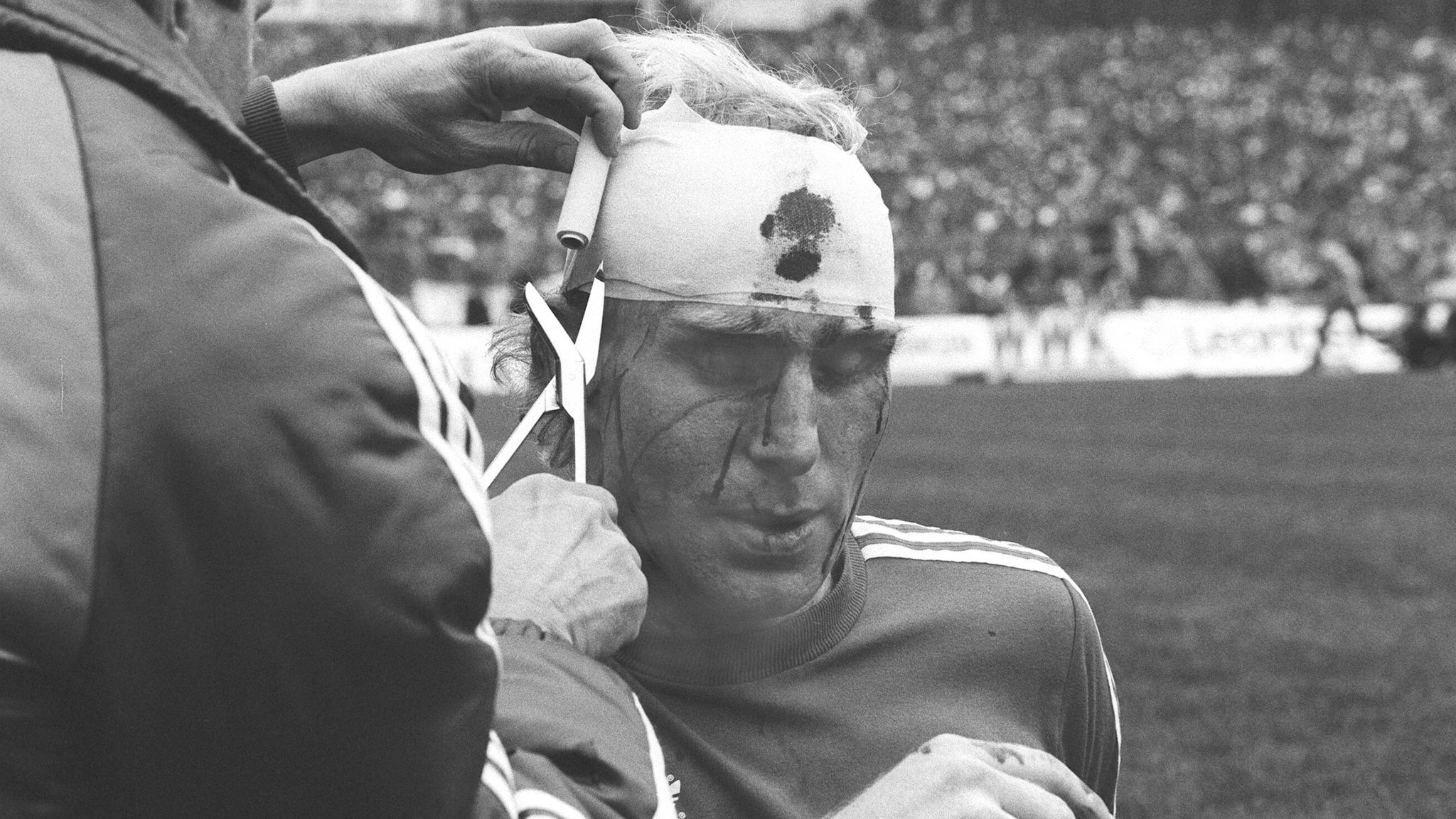 Dieter Hoeneß mit blutverschmierten Turban im DFB-Pokalendspiel 1982