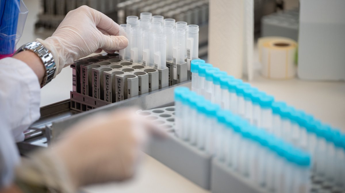 Gießen: Eine Labormitarbeiterin bereitet im Bioscientia MVZ Labor Mittelhessen Teströhrchen für einen PCR-Test vor. 
