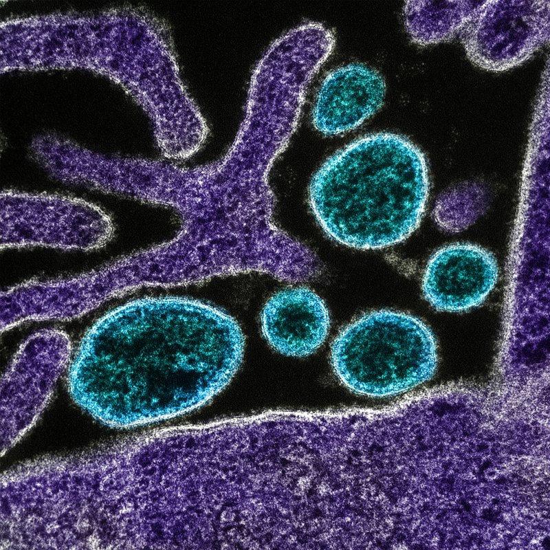 Das neue Corona? - Nipah, Dengue und andere Viren, wie gut sind wir gerüstet? - IQ - Wissenschaft und Forschung | BR Podcast
