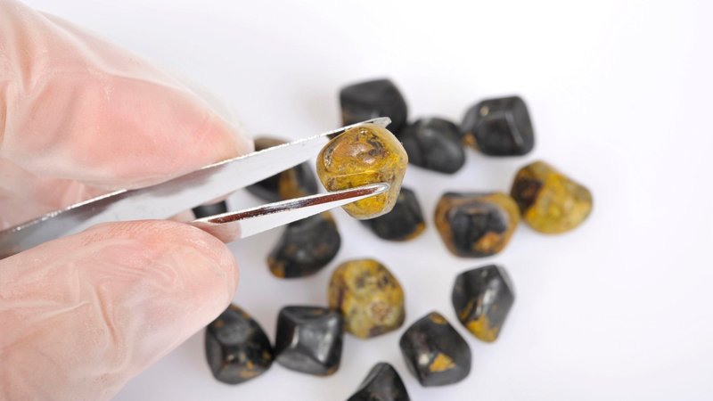 Eine Hand mit Gallensteinen | Bild: picture-alliance / imageBROKER | Ulrich Niehoff Eine Hand mit Gallensteinen