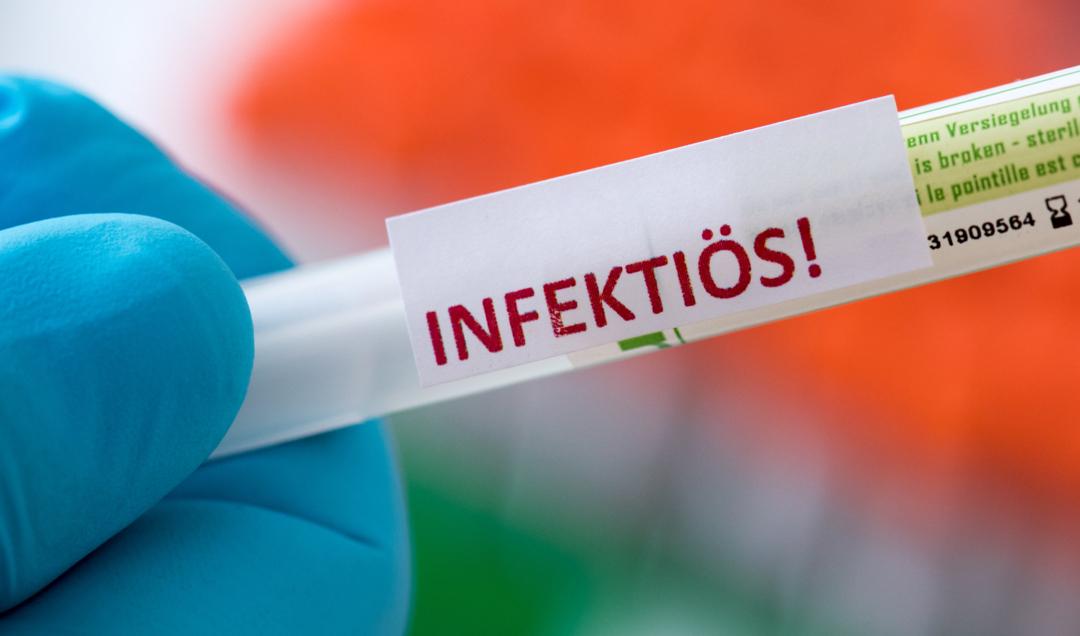 Probe für Coronatest (Symbolbild) | Bild:dpa-Bildfunk/Hendrik Schmidt