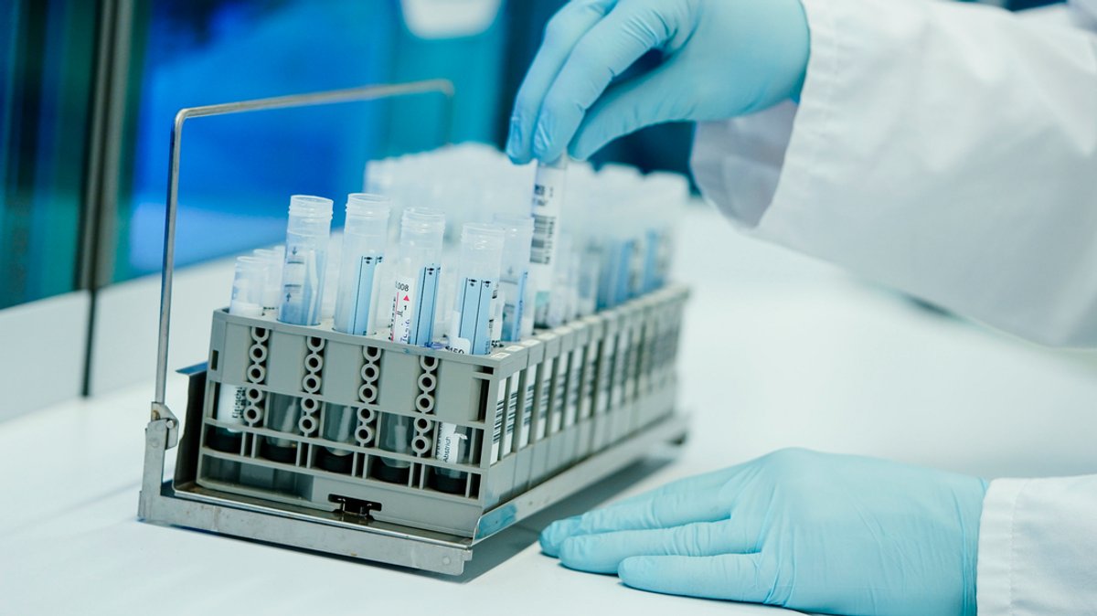 Ein Mitarbeiter hält in einem Coronatest-Labor der Limbach Gruppe Teströhrchen in den Händen (Symbolbild)