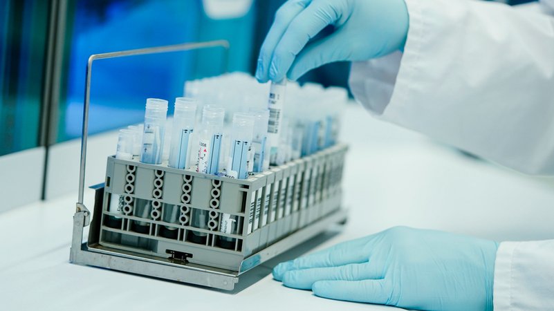 Ein Mitarbeiter hält in einem Coronatest-Labor der Limbach Gruppe Teströhrchen in den Händen (Symbolbild)