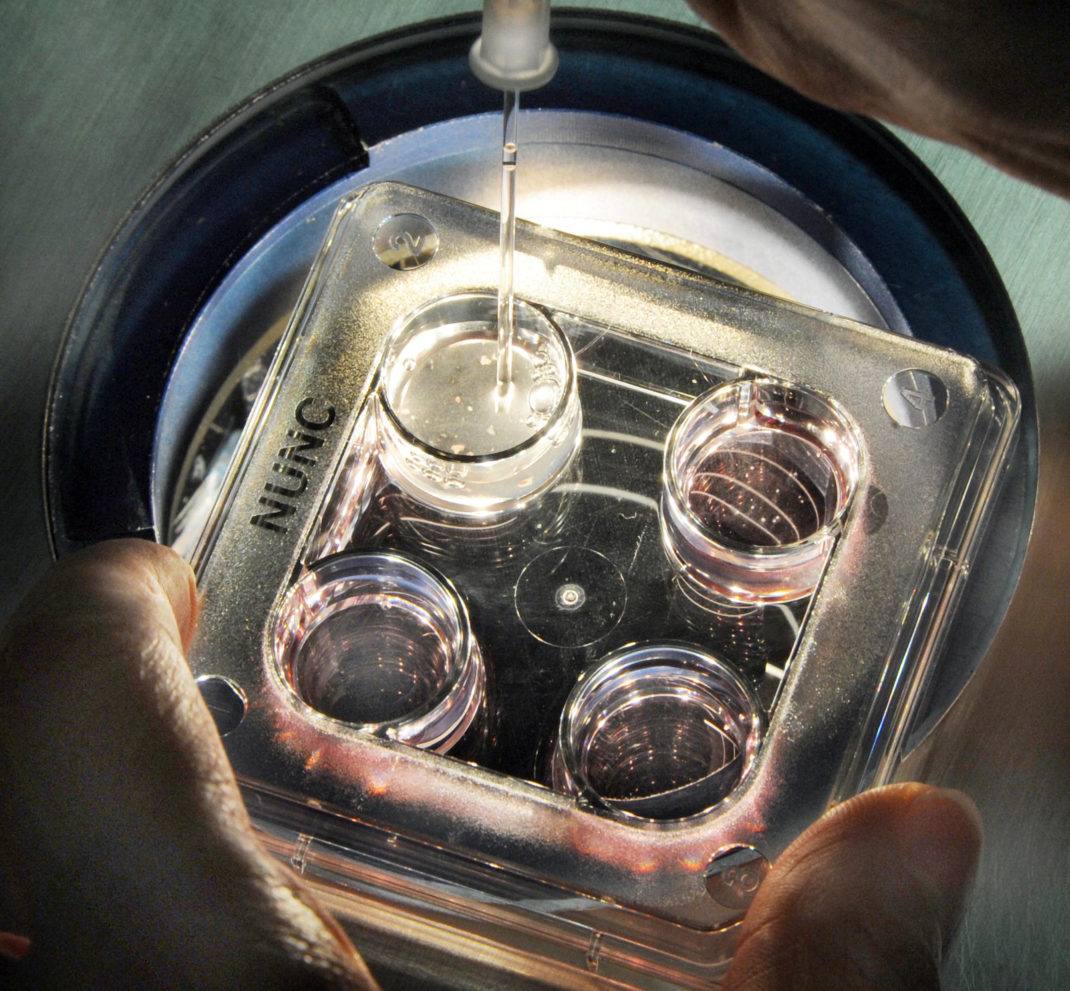 Pipette in erleuchtete Petrischale mit Embryonen für Präimplantationsdiagnostik; der Umgang mit solchen Zellhaufen wirft ethische Fragen auf.