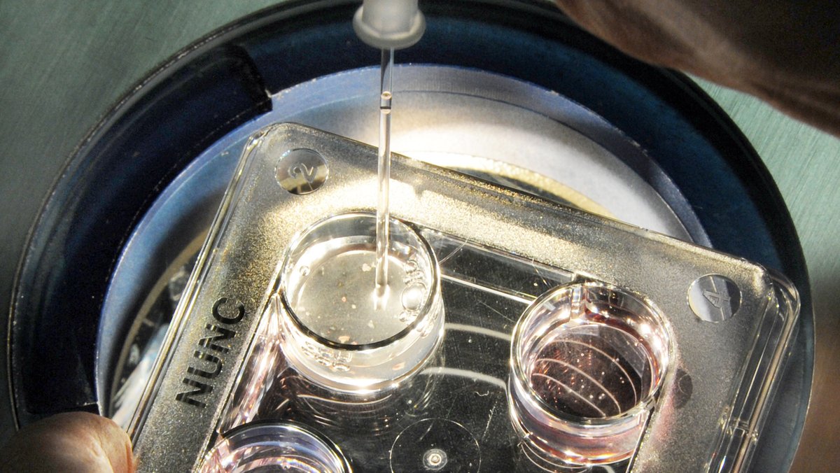 Pipette in erleuchtete Petrischale mit Embryonen für Präimplantationsdiagnostik; der Umgang mit solchen Zellhaufen wirft ethische Fragen auf.