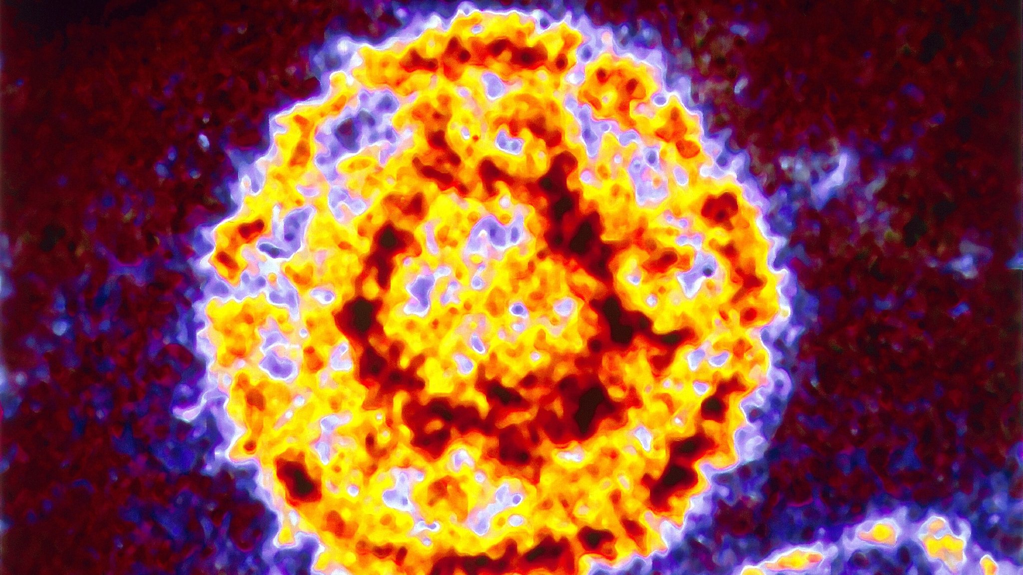 Epstein-Barr-Virus in Vergrößerung