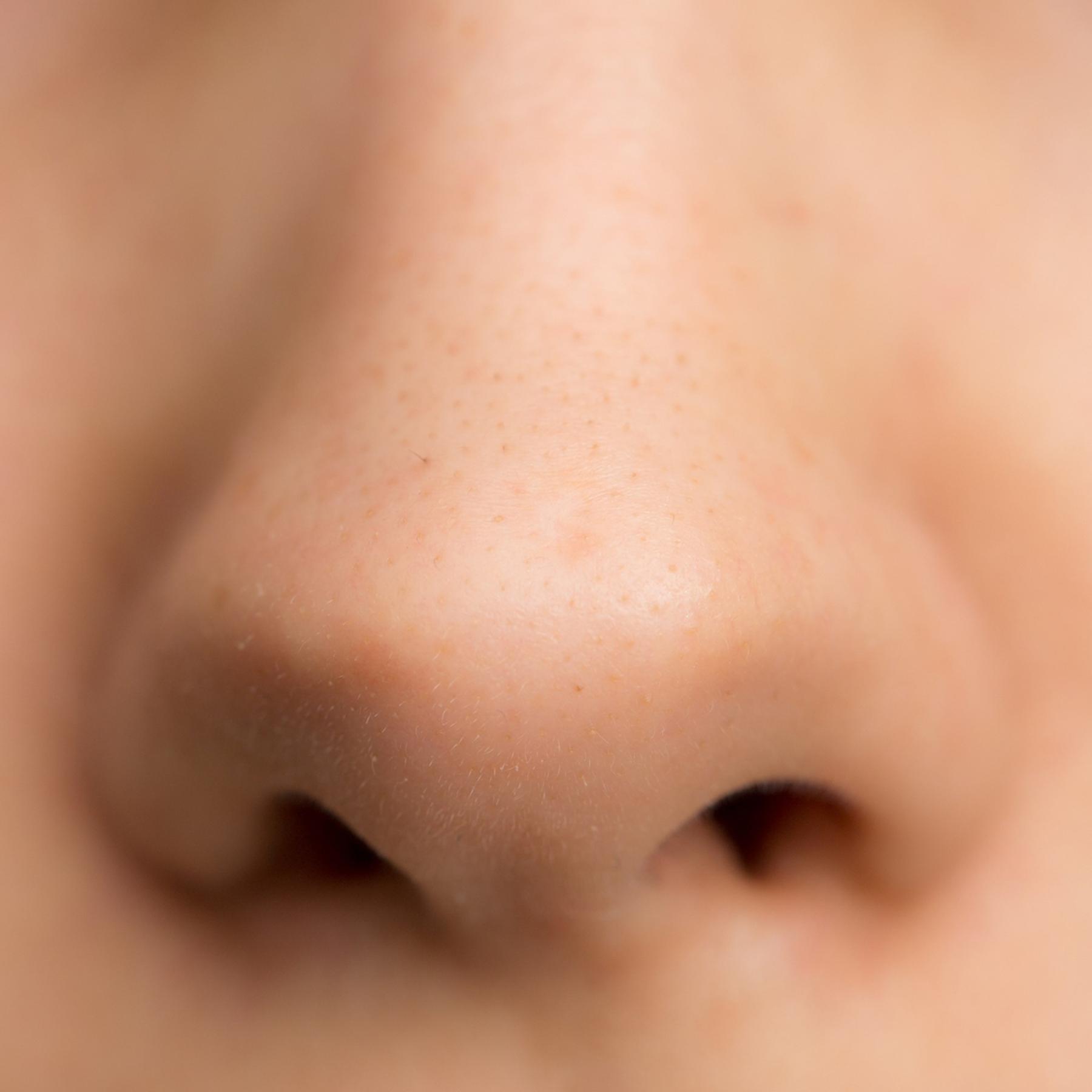 Die Nase