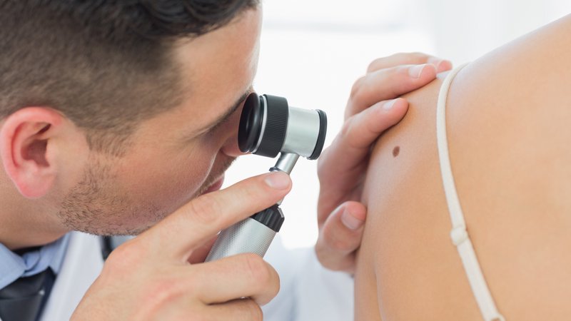 Ein Hautarzt untersucht einen Leberfleck mit dem Auflicht-Mikroskop | Bild: Adobe Stock Photos Ein Hautarzt untersucht einen Leberfleck mit dem Auflicht-Mikroskop