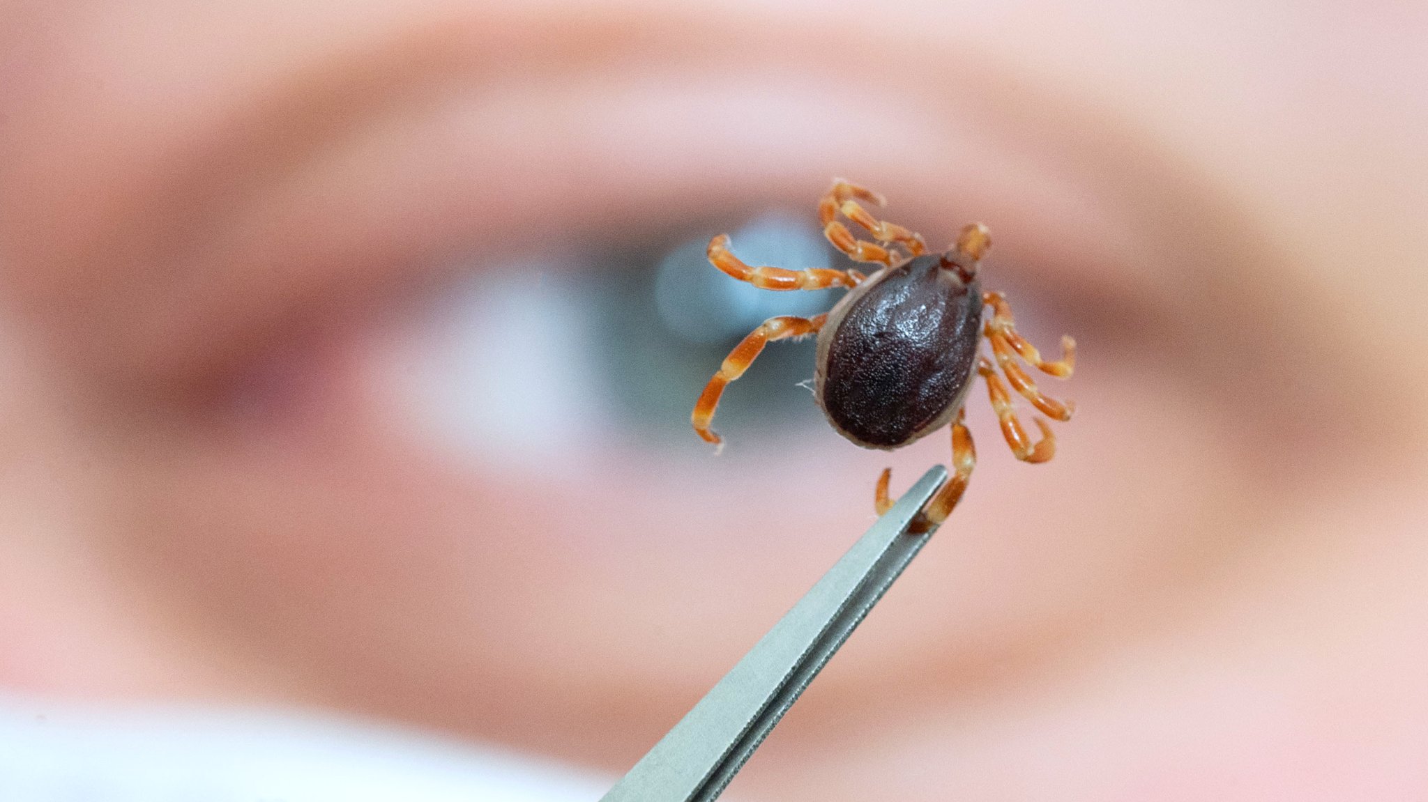 Ein Mitarbeiter des Instituts für Zoologie, Fachgebiet Parasitologie, der Universität Hohenheim, zeigt eine tote, haarige Hyalomma.