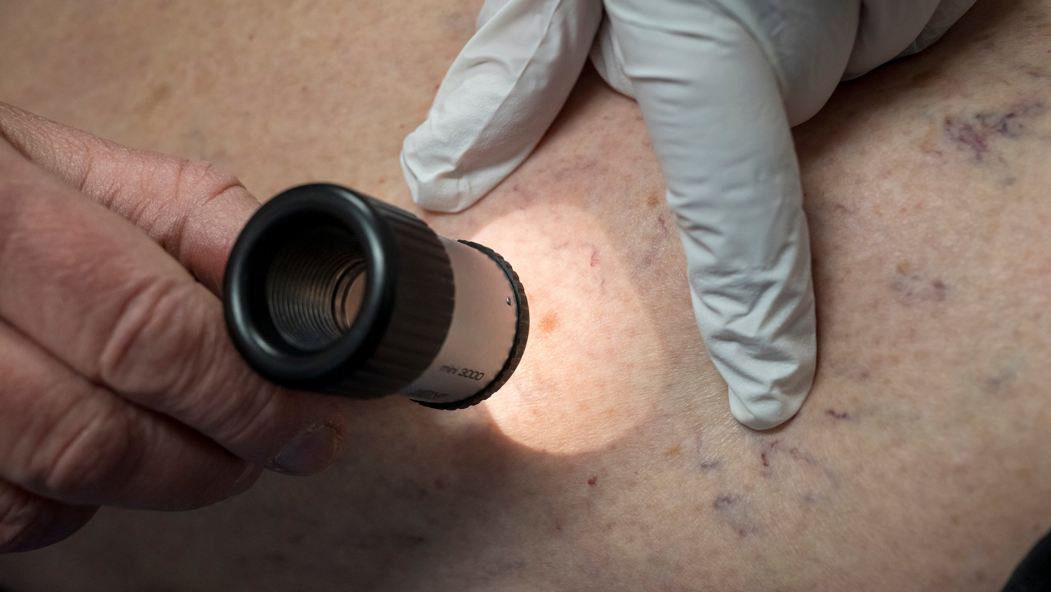 Krankenkassenreform beschlossen: Das ändert sich für Versicherte