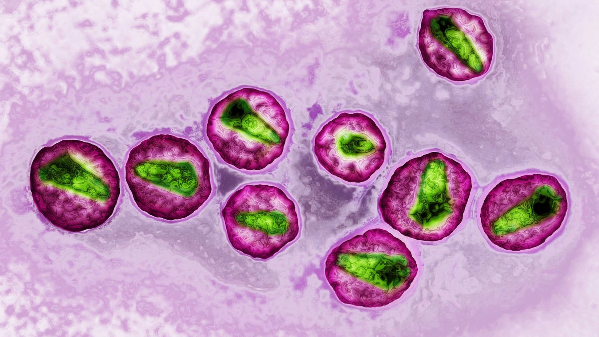 HI-Viren, die die Immunschwächekrankheit AIDS auslösen können.
