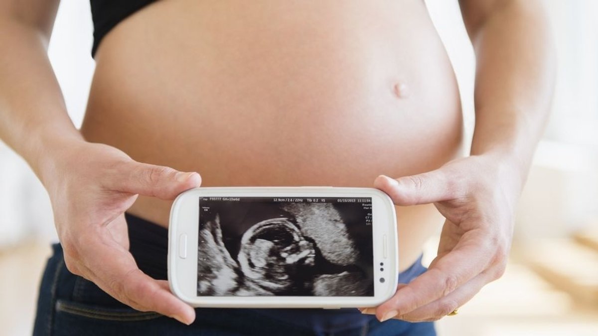 Schwangere zeigt Embryo auf ihrem Smartphone.