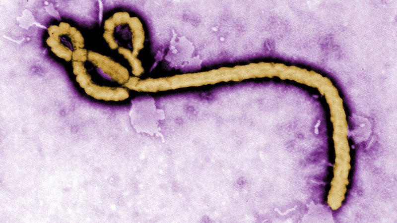 ARCHIV - 12.05.2017, USA, ---: Datum und Ort unbekannt: Die Aufnahme eines Elektronenmikroskops zeigt ein einzelnes Viruspartikel des Ebola-Virus. (zu dpa: «Ebola-Verdachtsfall in Tschechien») Foto: Frederick Murphy/CDC/AP/dpa +++ dpa-Bildfunk +++ | Bild: dpa-Bildfunk/Frederick Murphy ARCHIV - 12.05.2017, USA, ---: Datum und Ort unbekannt: Die Aufnahme eines Elektronenmikroskops zeigt ein einzelnes Viruspartikel des Ebola-Virus. (zu dpa: «Ebola-Verdachtsfall in Tschechien») Foto: Frederick Murphy/CDC/AP/dpa +++ dpa-Bildfunk +++
