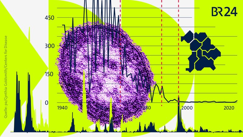 (Symbolbild) Collage mit Masern-Virus Diagrammen. | Bild: pa/Cynthia Goldsmith/Centers for Disease Collage: BR (Symbolbild) Collage mit Masern-Virus Diagrammen.
