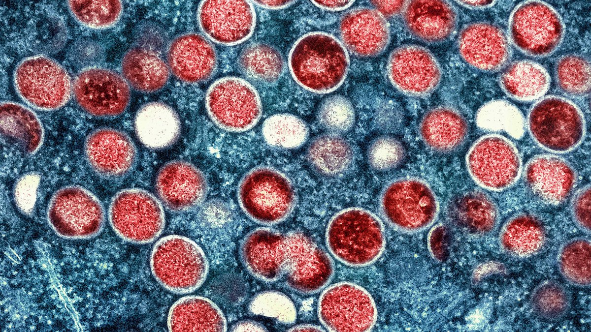 Eine kolorierte transmissionselektronenmikroskopische Aufnahme von Partikeln des Affenpockenvirus (rot) in einer infizierten Zelle (blau)