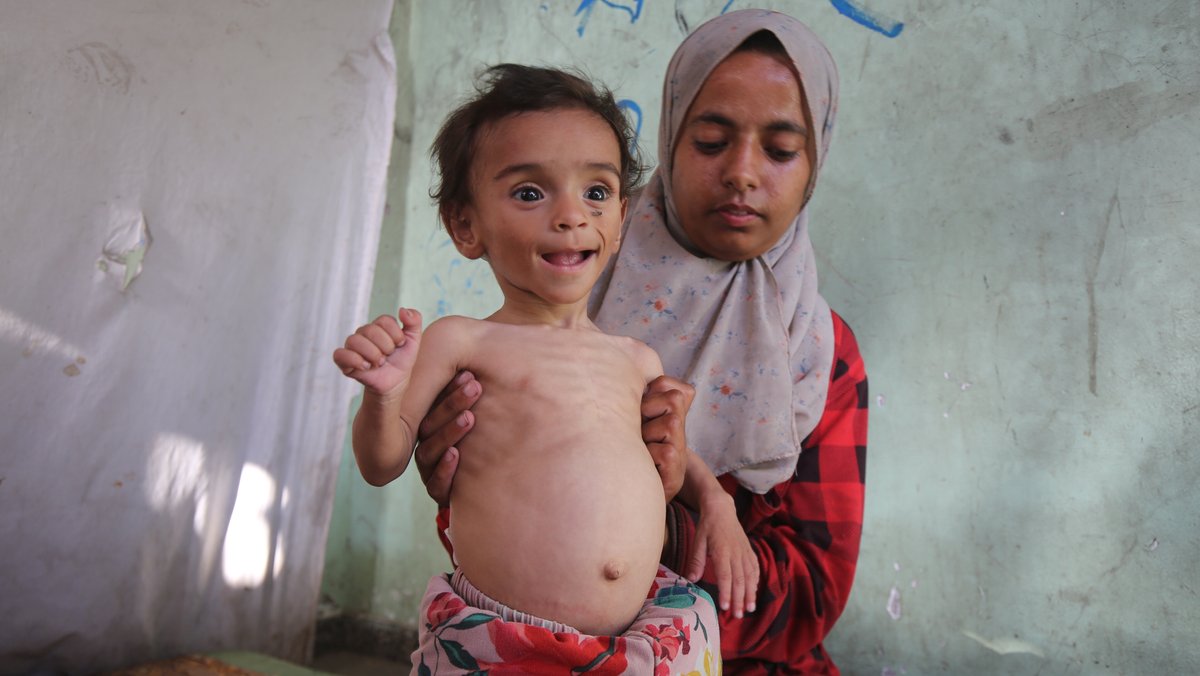 Zu sehen ist ein 9 Monate alter palästinensischer Junge, der von seiner Mutter aufrecht gehalten wird. Sein Hungerbauch zeigt: Er leidet unter Hunger.