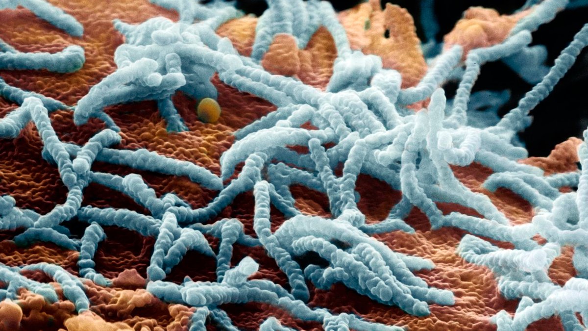 Vogelgrippe-Viren - hier blaugefärbt - befallen eine Zelle.