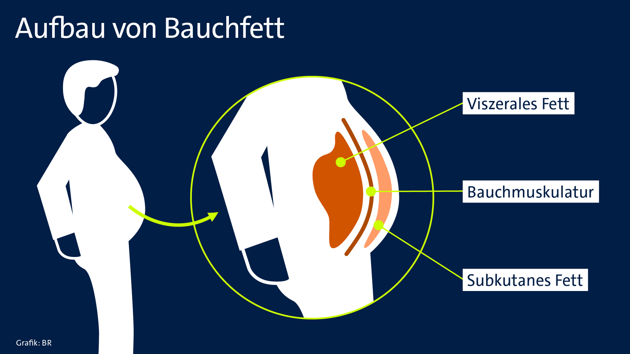 Grafik über die verschiedenen Schichten Fett im Bauch