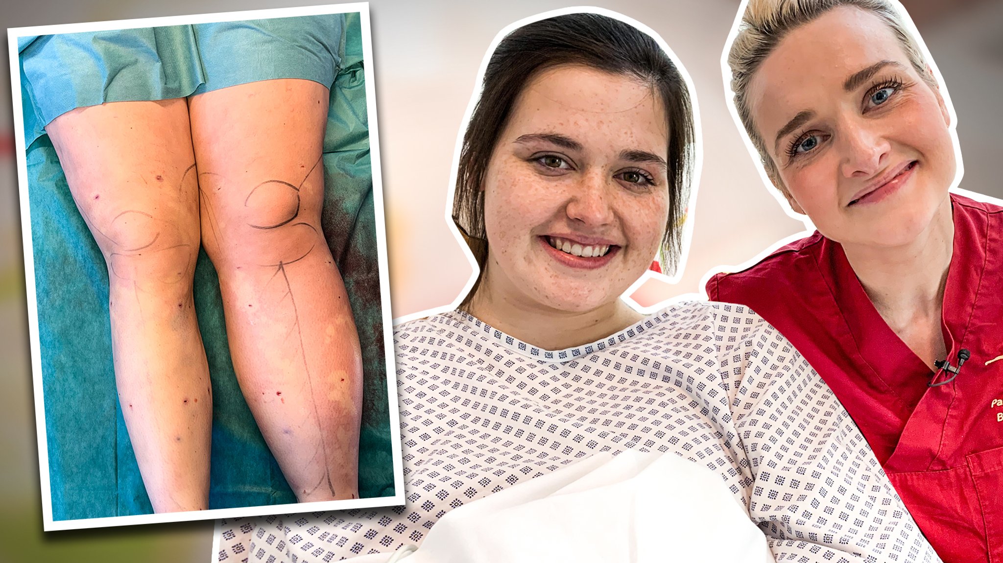 Die Protagonistin des Films und Ariane Alter. Daneben ein Bild mit einem Lipödem an Beinen. | Bild: BR Die Protagonistin des Films und Ariane Alter. Daneben ein Bild mit einem Lipödem an Beinen.
