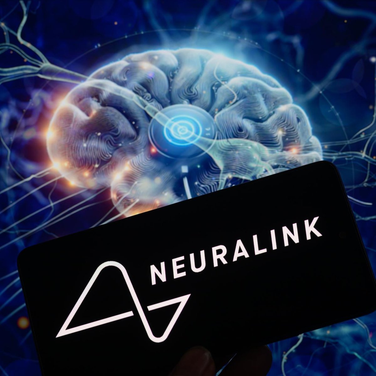 Neuralink Chip im Hirn - können wir damit heilen? 