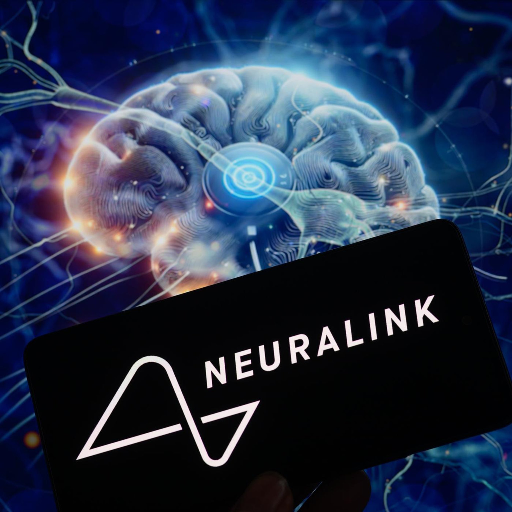 Neuralink Chip im Hirn - können wir damit heilen? 