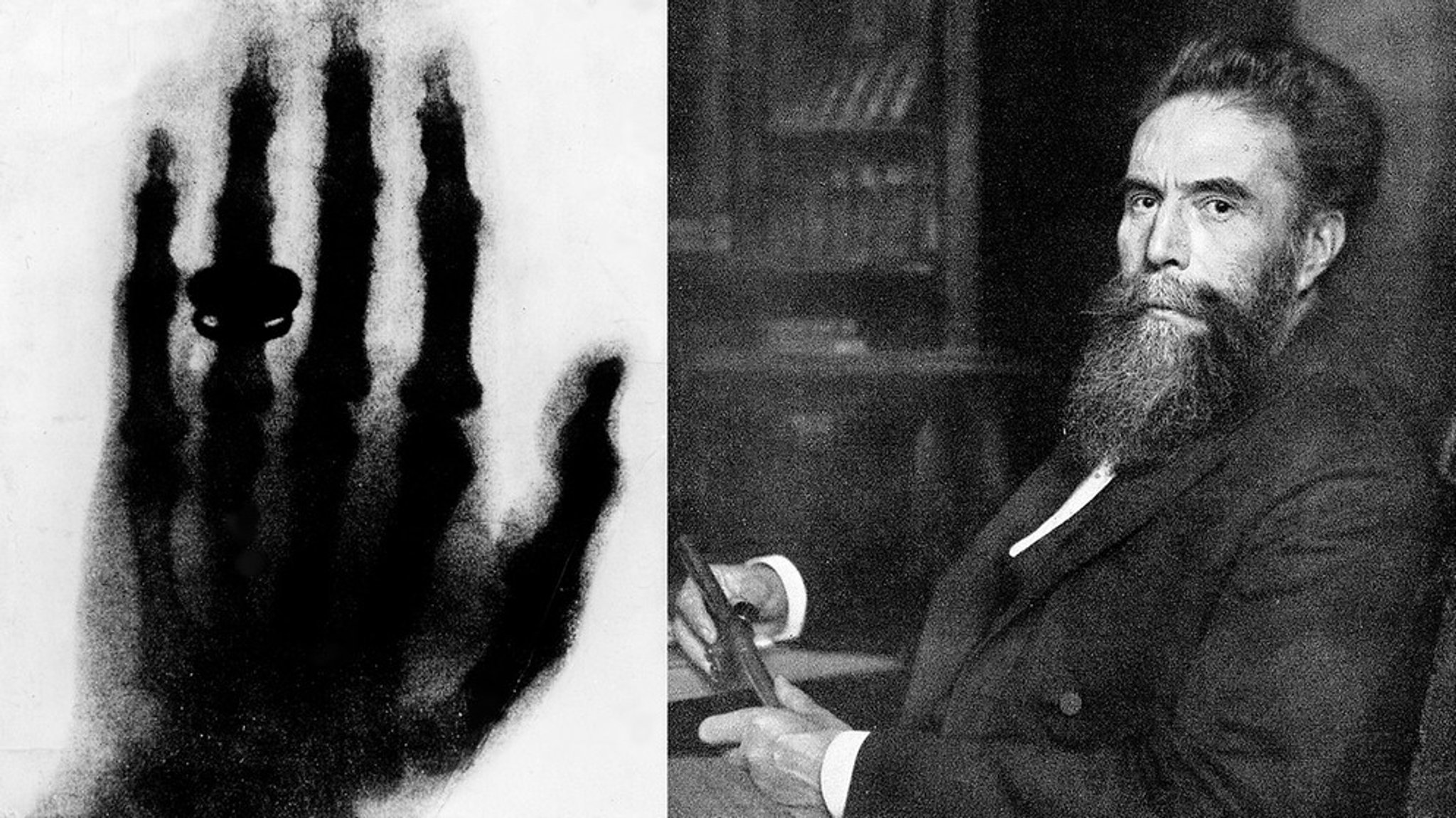 Wilhelm Conrad Röntgen: Die Röntgenstrahlung entdeckte er in Würzburg ganz zufällig