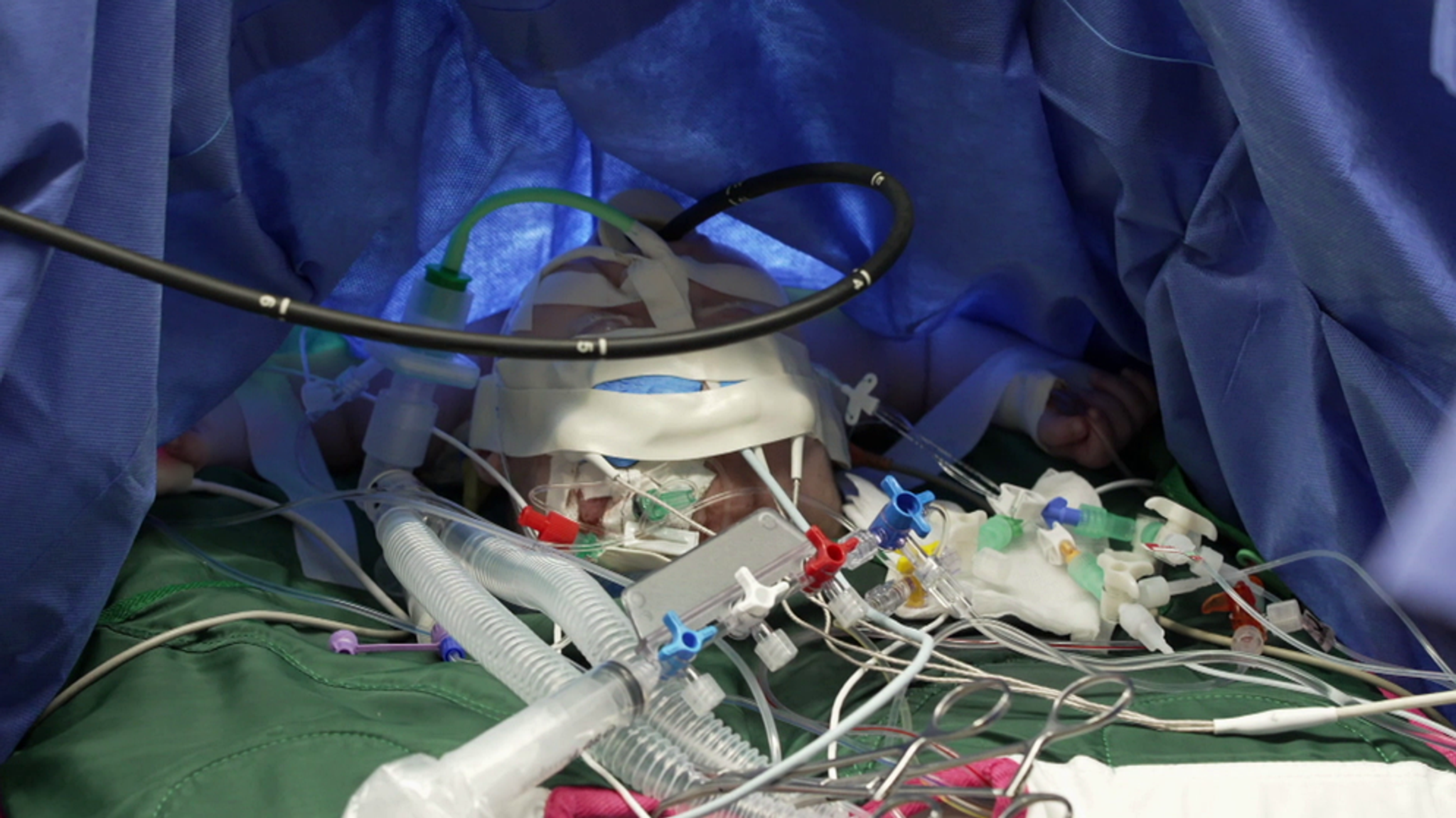 Angeborene Herzfehler: Leben mit angeborenen Herzfehlern  