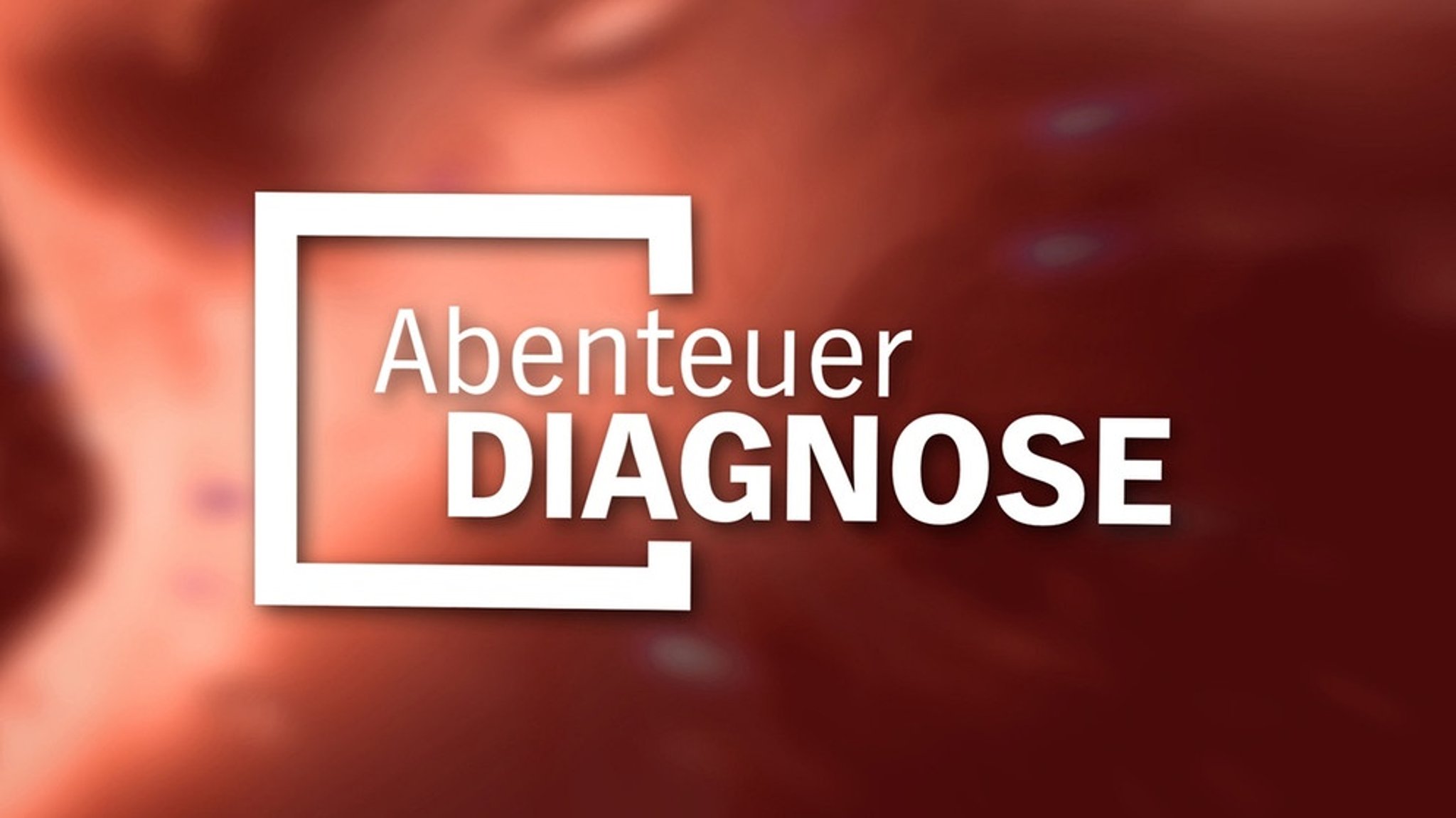 alpha-thema: Seltene Krankheiten: Abenteuer Diagnose